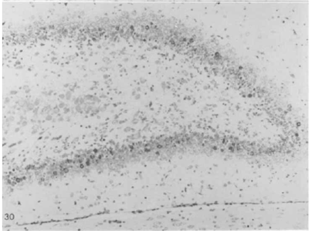 New neurons in the granular layer of the hippocampus. Fig. 30 from Altman & Das (1965). 